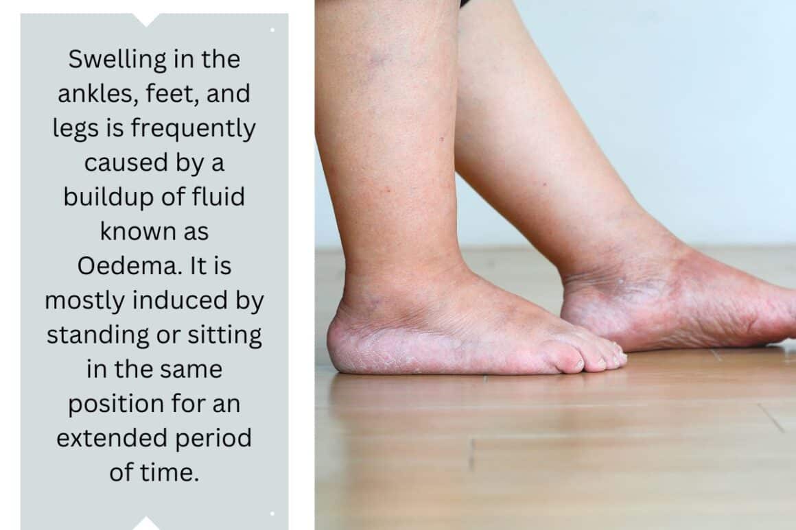 How to Prevent Feet Swelling When Sitting in an Office Chair?